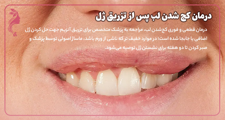 درمان کج شدن لب پس از تزریق